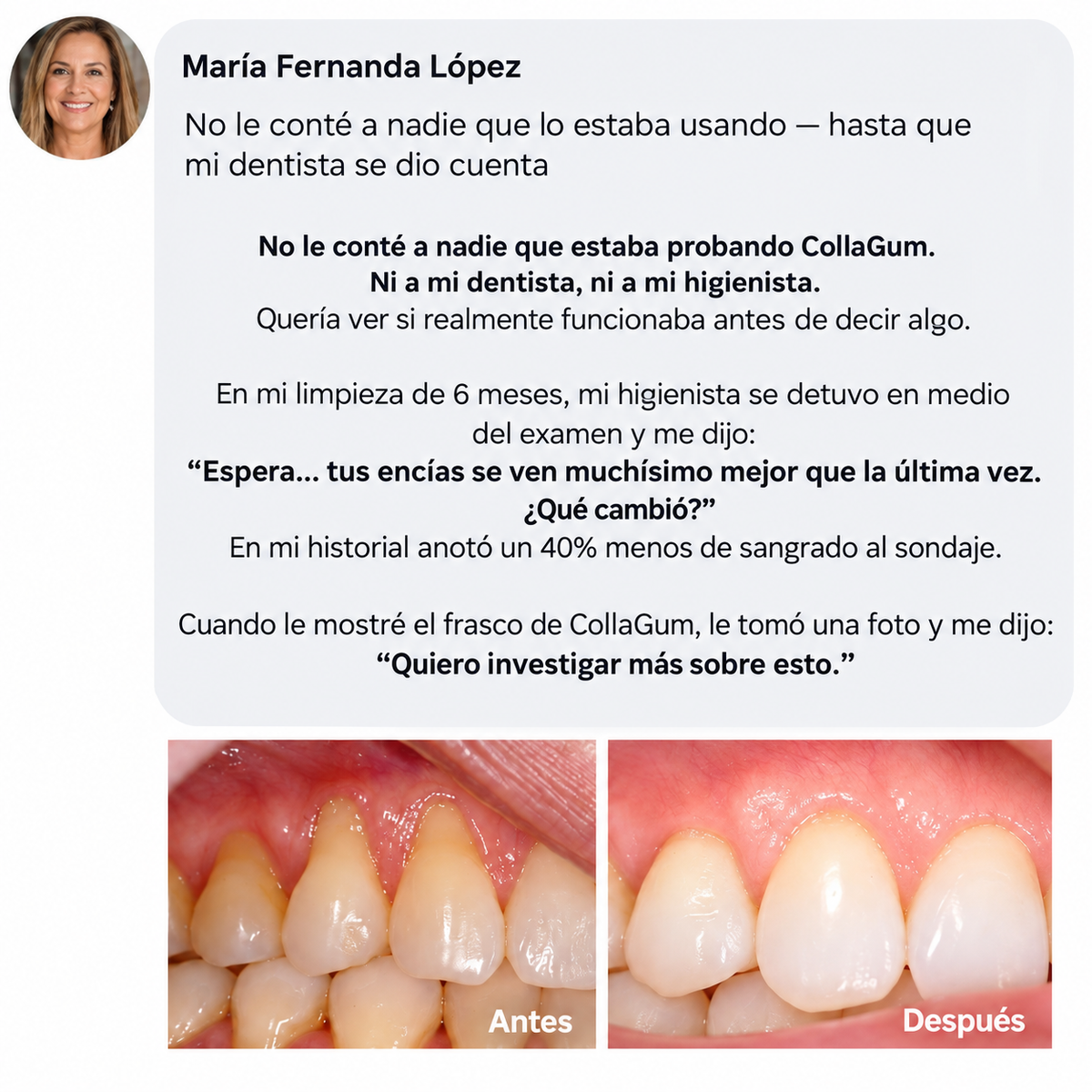 Nivora - Polvo de colágeno para las encías