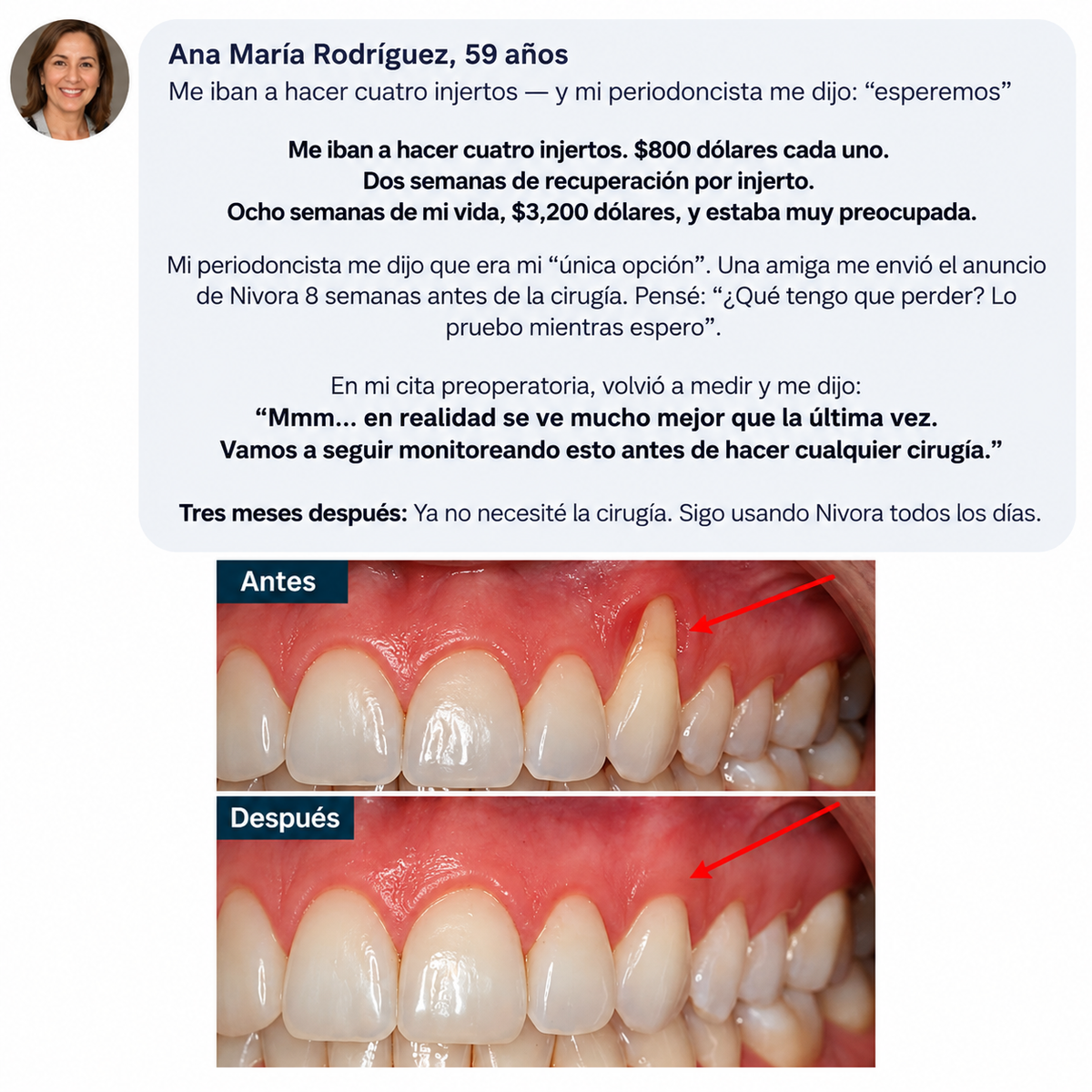 Nivora - Polvo de colágeno para las encías